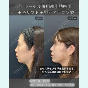 症例