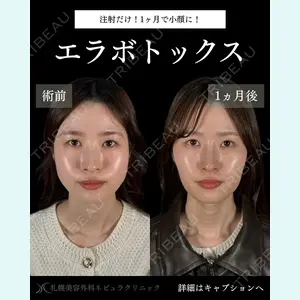 症例