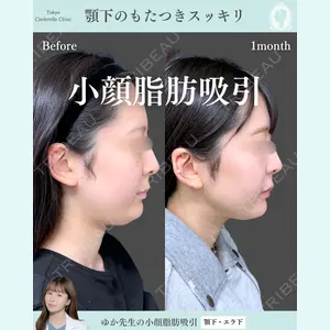 症例