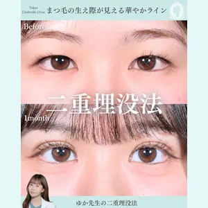 症例