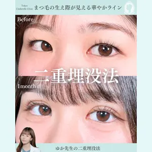 症例