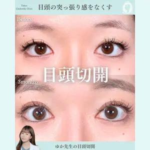 症例