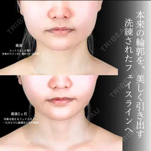 アリエル美容クリニック 横浜院 渡邉 光医師の症例