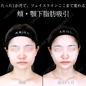 アリエル美容クリニック 横浜院 渡邉 光医師の症例