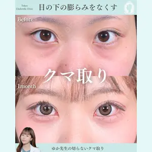 症例