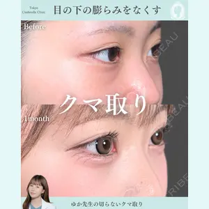 症例
