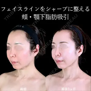 アリエル美容クリニック 郡山院 安齋 誠基医師の症例
