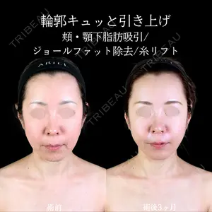 アリエル美容クリニック 郡山院 安齋 誠基医師の症例