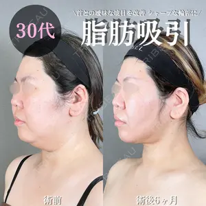 アリエル美容クリニック 大宮院 鈴木　桂介医師の症例