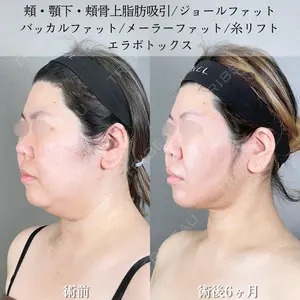 アリエル美容クリニック 大宮院 鈴木　桂介医師の症例