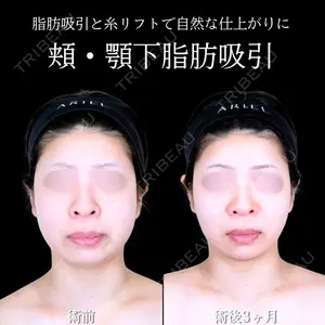 アリエル美容クリニック 横浜院 渡邉 光医師の症例