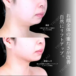 アリエル美容クリニック 横浜院 渡邉 光医師の症例