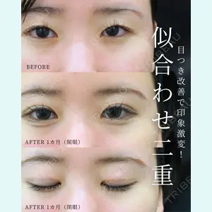 症例