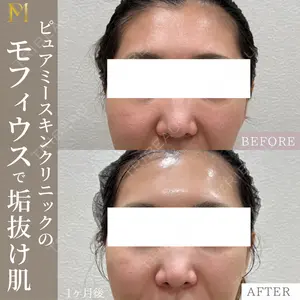 症例