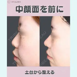 吉祥寺アイビークリニック 巴 窓花医師の症例