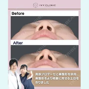 症例