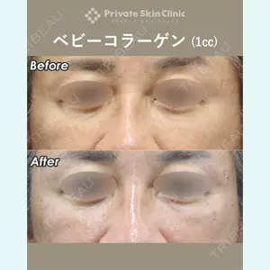 症例