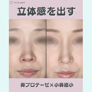 症例