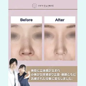 症例