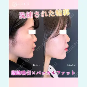 症例