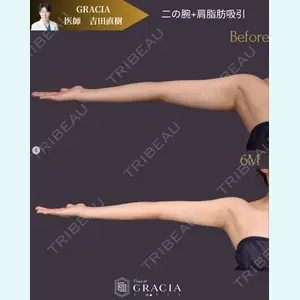 症例