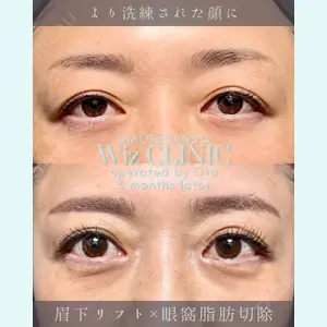 症例