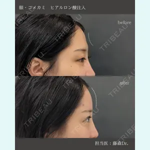 症例
