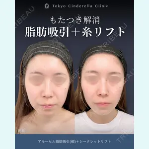 症例