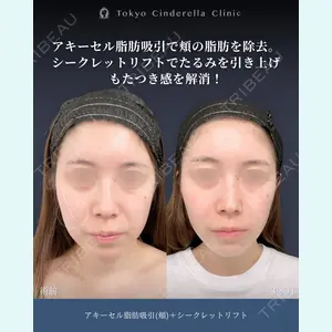症例