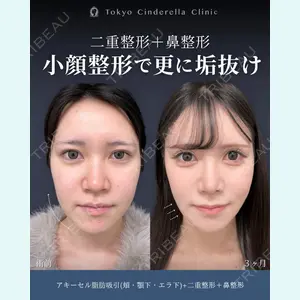 症例