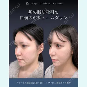 症例