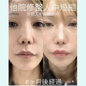 症例