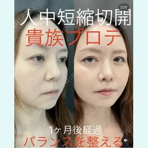 症例