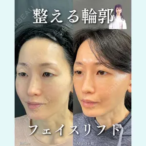ルラ美容クリニック 渋谷本院 住友 沙織医師の症例