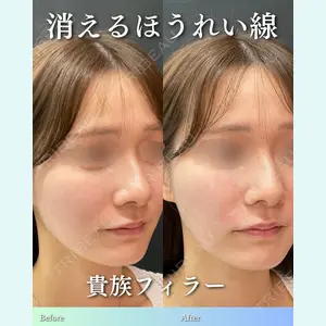 ルラ美容クリニック 渋谷本院 住友 沙織医師の症例