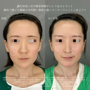 ASTRA BEAUTY CLINIC 塩満 惠子医師の症例
