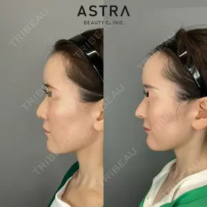 ASTRA BEAUTY CLINIC 塩満 惠子医師の症例