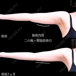 症例