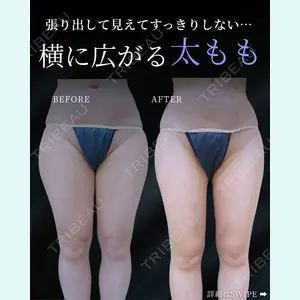 症例
