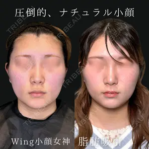 Wing clinic 豊中駅前院 速水 翼医師の症例