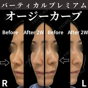 症例