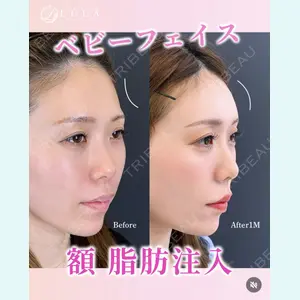 症例