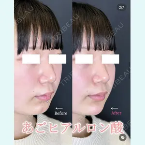 症例