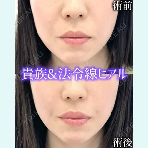 症例