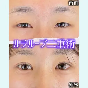 症例