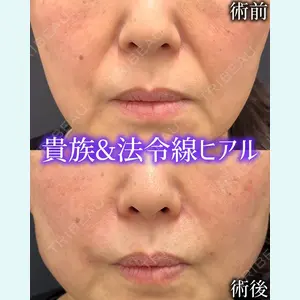 症例