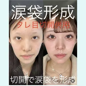 症例