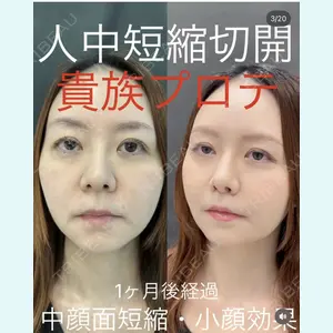 症例