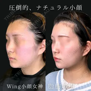 Wing clinic 豊中駅前院 速水 翼医師の症例