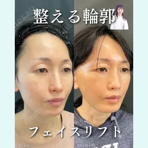 ルラ美容クリニック 渋谷本院 住友 沙織医師の症例